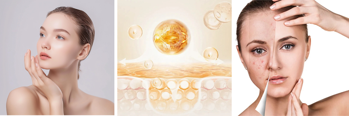 How does 4-Butylresorcinol Attain Perfect Skin? How does 4-Butylresorcinol Attain Perfect Skin?